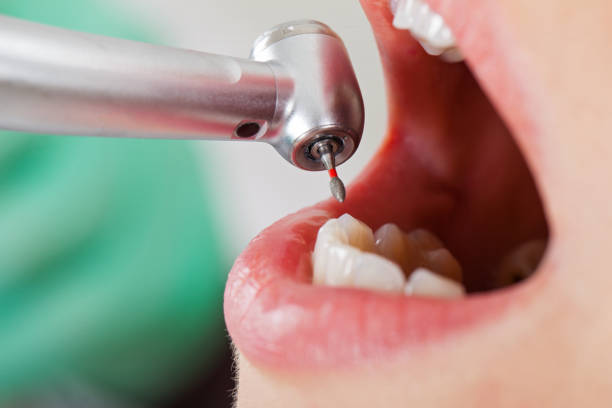 Best Emergency Broken Tooth Repair in Bardonia, NY